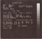 Erasure-4
